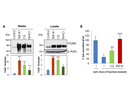 Alkalizing reagents increase intracellular and secreted GRN levels and might be promising candidates for a therapy approach