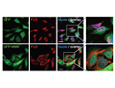 FUS localizes to cytoplasmic stress granules after inhibition of the Transportin pathway