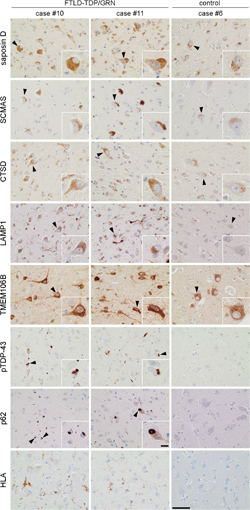 lysosomal-IHC-250