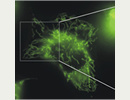 PINK1-deficient human cells show morphological abnormalities of mitochondria
