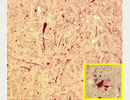 Pathological deposition of α-syunclein in transgenic mice expressing the A30P mutation (Neumann et al. (2002) J Clin Invest. 110(10): 1429–1439)