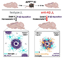 Early intervention anti-Aβ immunotherapy attenuates microglial activation without inducing exhaustion at residual plaques 