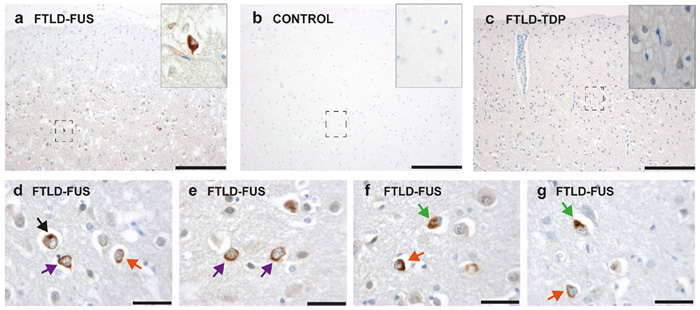 suarez-acta-neuropathol-fig7