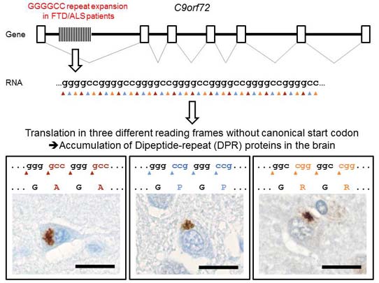 The C9orf72 GGGGCC Repeat Is Translated into Aggregating Dipeptide-Repeat Proteins in FTLD/ALS