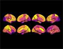 Microglial activation states drive glucose uptake and FDG-PET alterations in neurodegenerative diseases 