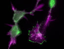 Immunofluorescent image of cultured cerebellar granule neurons co-stained with rhodamine-phalloidin (magenta) to visualize actin cytoskeleton and an antibody against actin regulatory protein WAVE (green)
